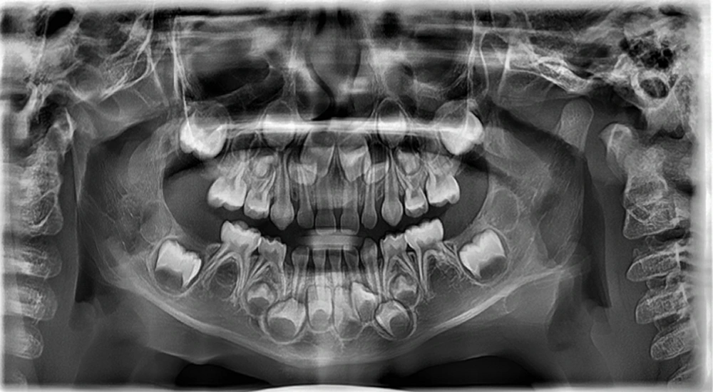 Panorámica del material publicitario de MaxiDental